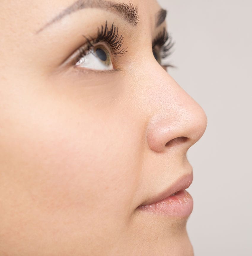patient-after-revision-rhinoplasty-2-allure-aesthetic-of-beverly-hills