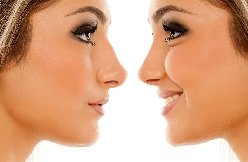 top-rhinoplasty-surgeon-in-beverly-hills-allure-aesthetic-of-beverly-hills-1