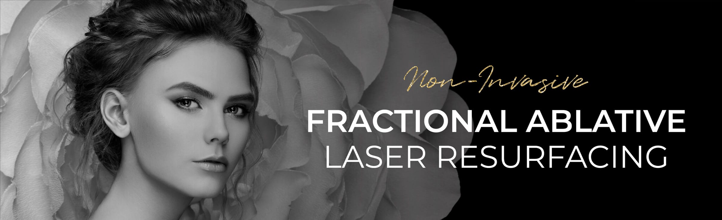 non-surgical-fractional-ablative-laser
