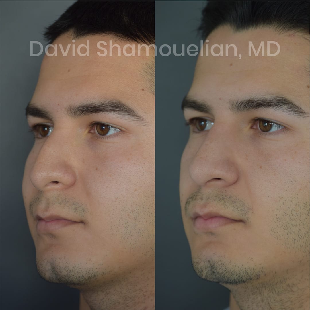patient-12-before-after
