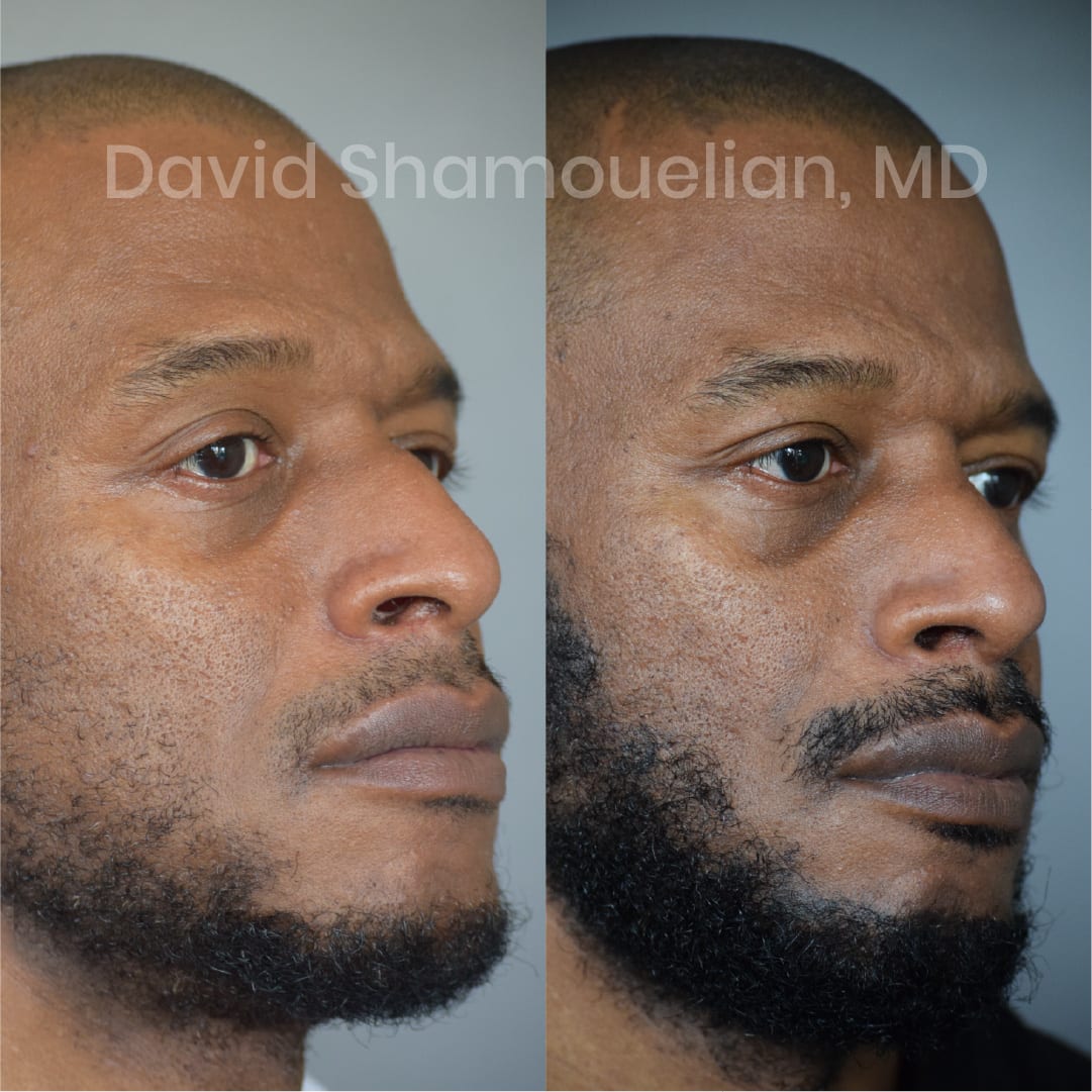 patient-10-before-after