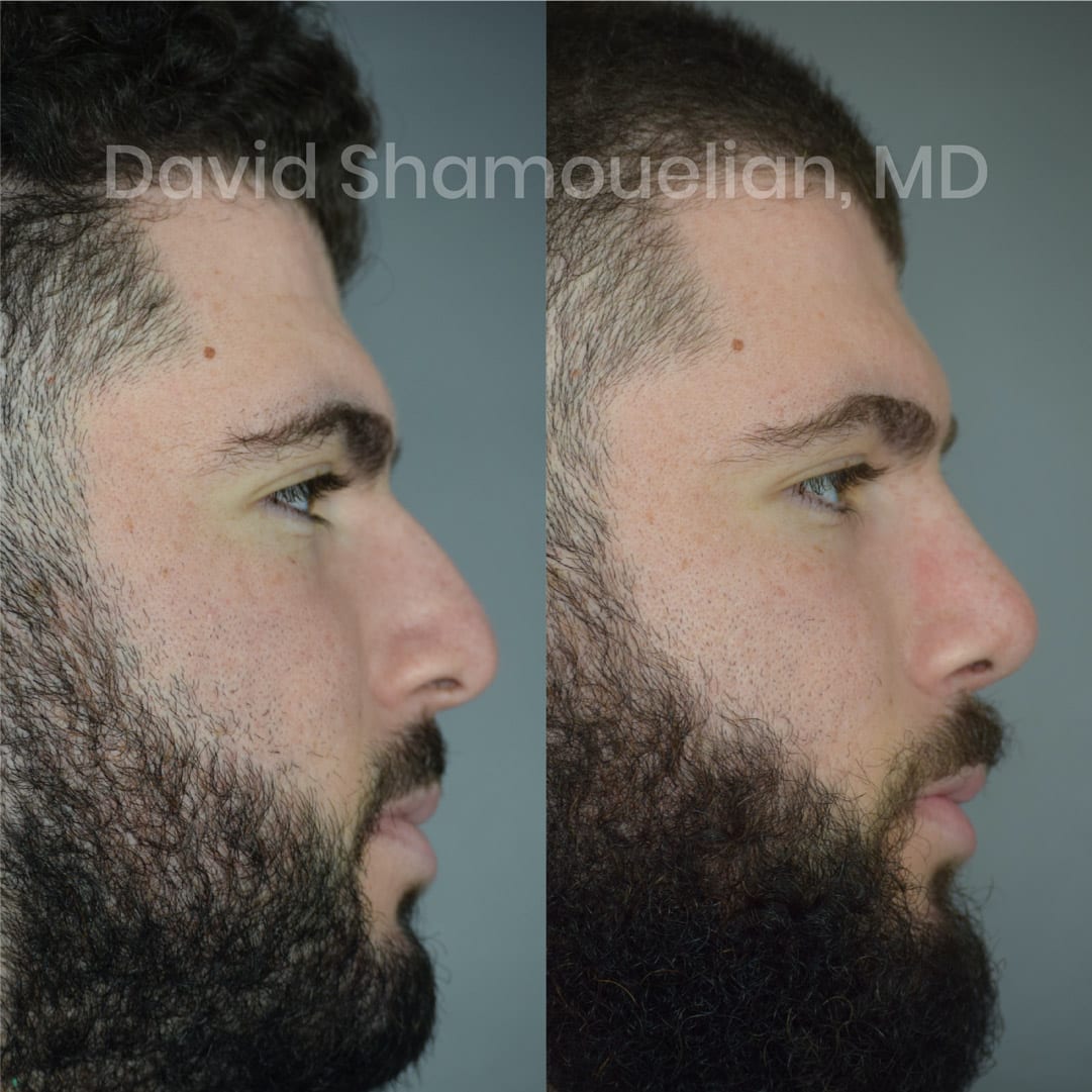 patient-16-before-after