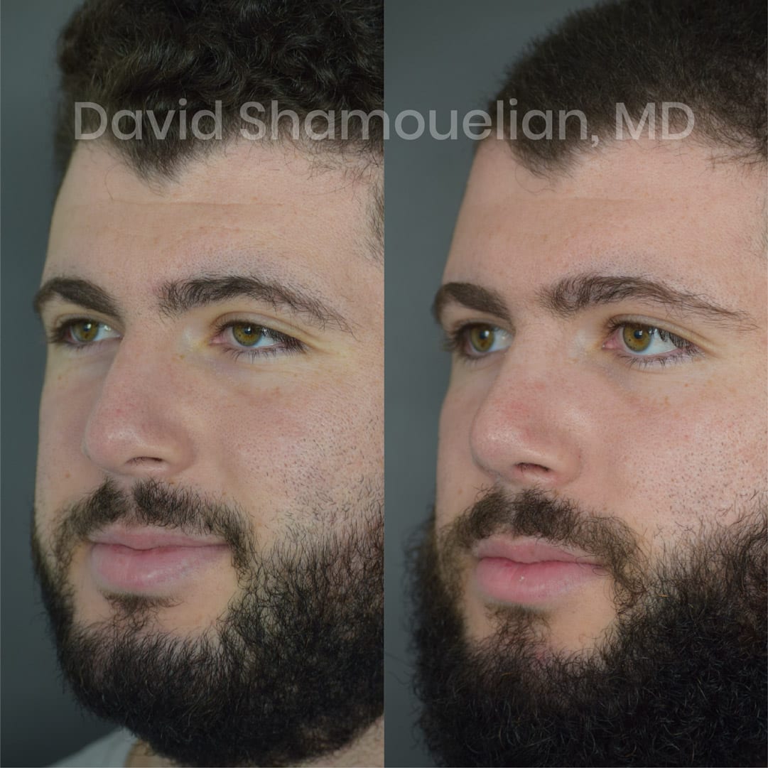 patient-16-before-after