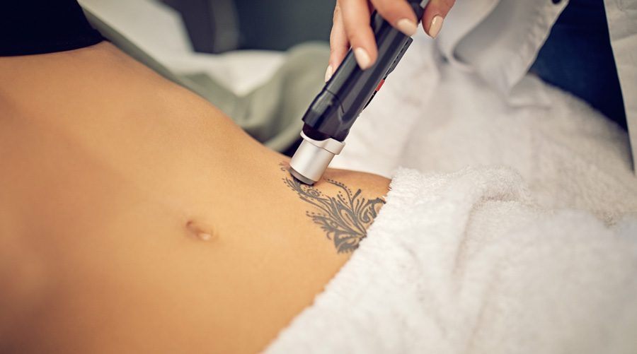 woman-receiving-laser-tattoo-removal