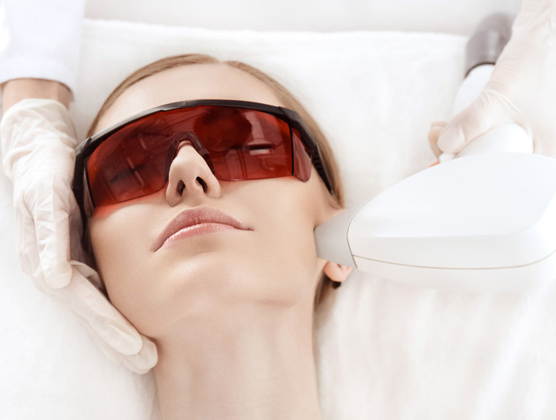 Woman-receiving-IPL-laser-treatment-on-her-face