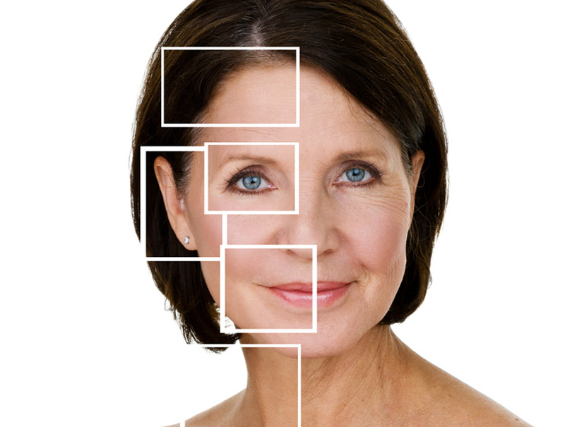 facelift-cosmetic-surgeon-in-Beverly-Hills-Allure-Aesthetics-of-Beverly-Hills-1